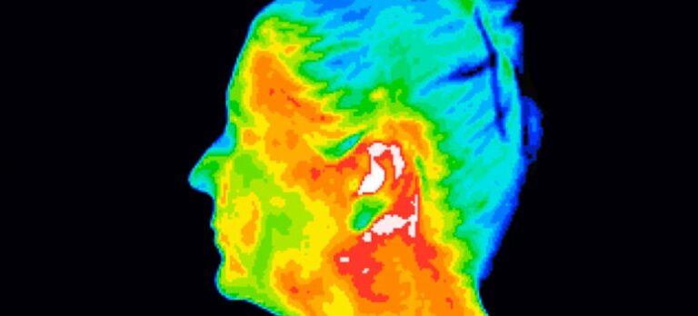 Medicinsk Thermografi: Inflammation – kroppens råb om hjælp